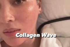 CollagenWave1-30-2023
